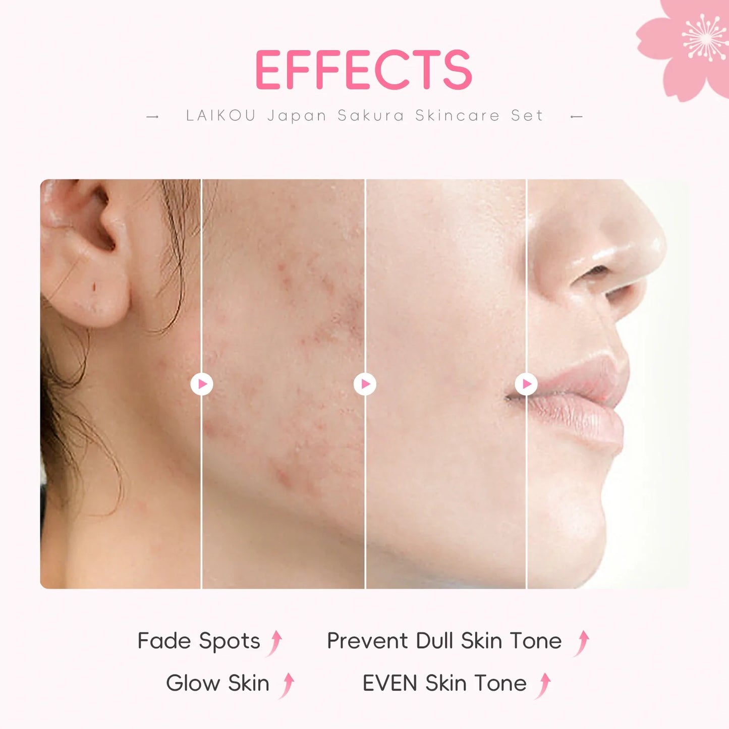 4 PCS Face Skin Care Set Cleanser Sakura Essence Cream Moisturizing Eye Cream Face Serum Improve Roughness & Dryness Skin Care